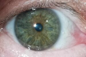Gałka oka w zbliżeniu