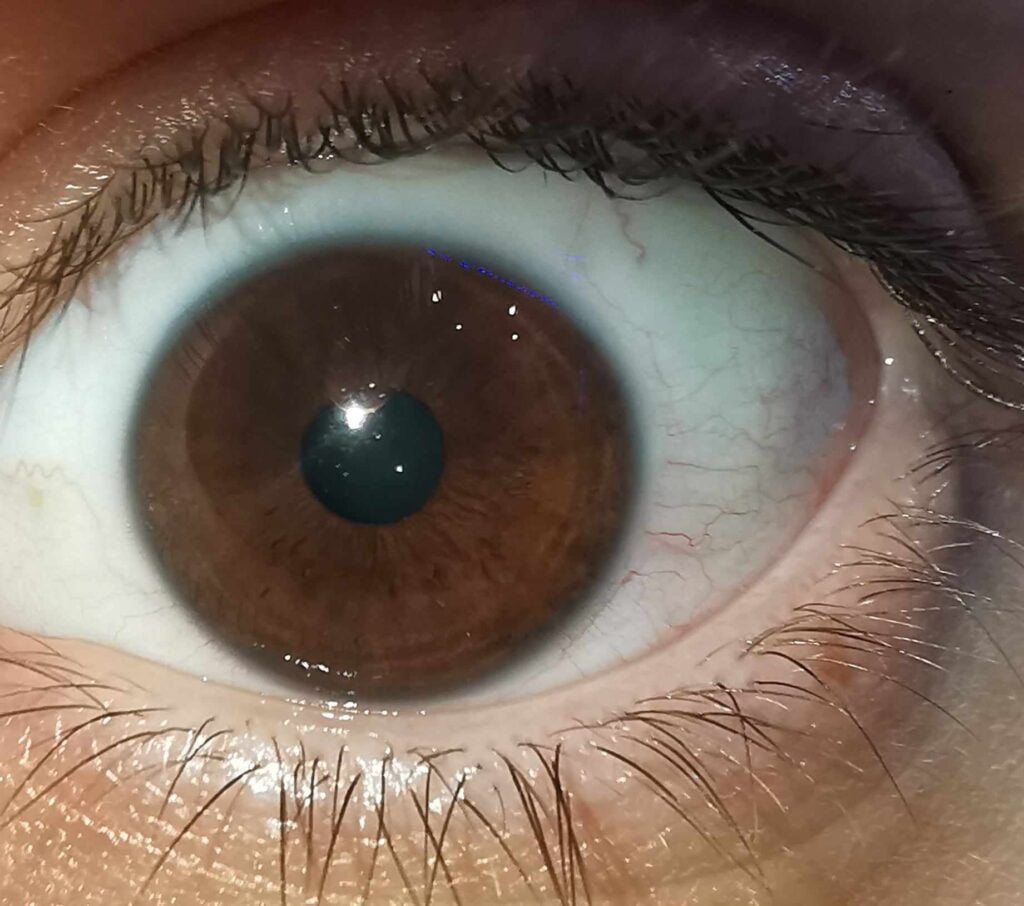 rogówka oka w zbliżeniu