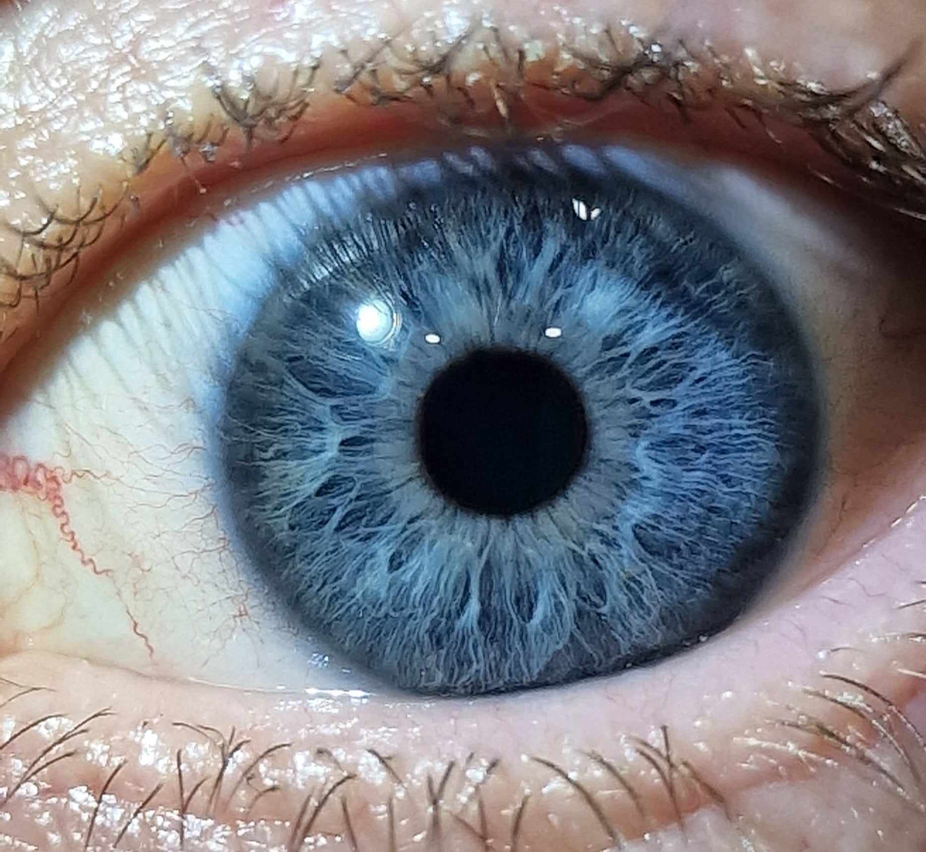 Irydologia badanie Inowrocław